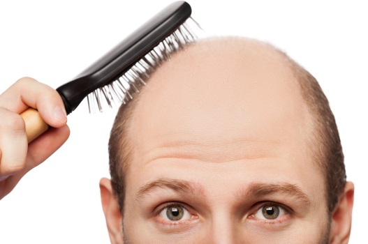 Toppik ocultar la caída de cabello es fácil y rápido