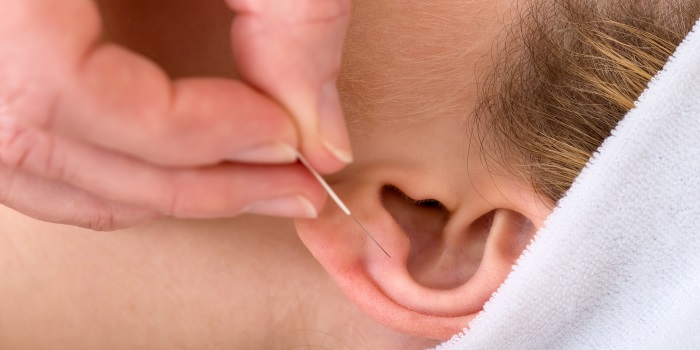 Auriculomedicina de Paul Nogier que es